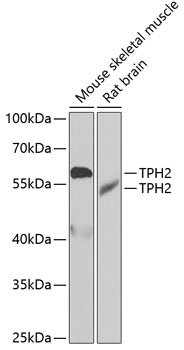 TPH2 Antibody