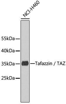 Tafazzin / TAZ Antibody