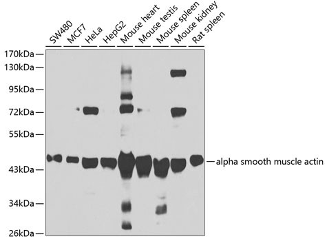 alpha smooth muscle actin Antibody