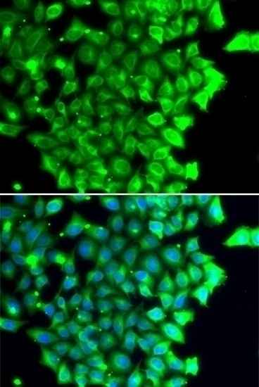 TRIAP1 Antibody