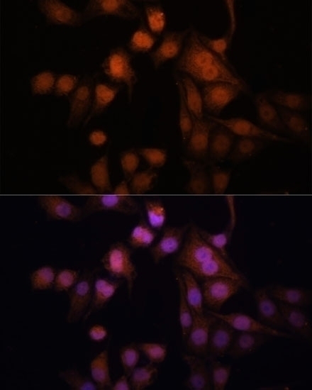 TWIST1 Antibody