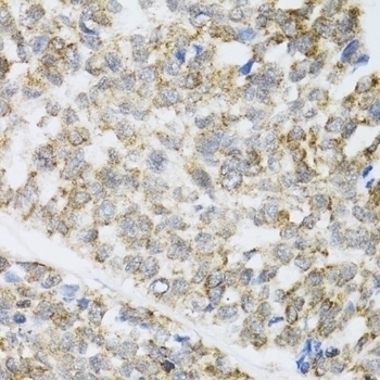 ZAK Antibody