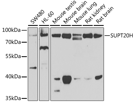 SUPT20H Antibody