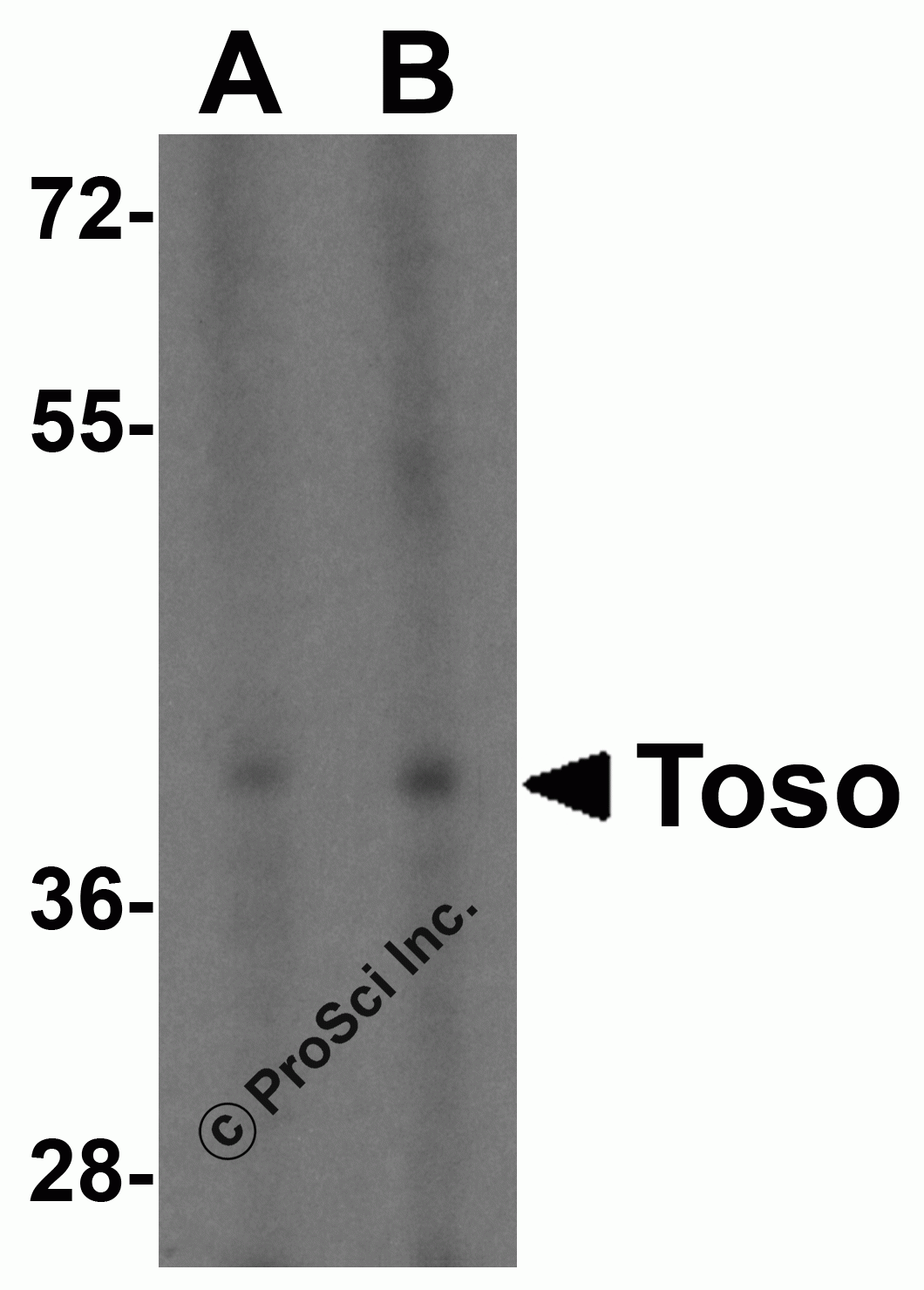 Toso Peptide