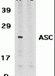 Western blot analysis of ASC in HL60 whole cell lysate in the absence (A) or presence (B) of blocking peptide (2287P) with ASC antibody at 1 μg /ml.