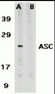 ASC Peptide