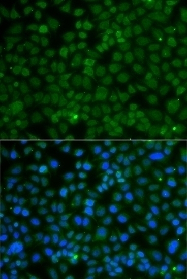 WDR45 Antibody