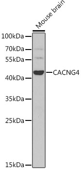 CACNG4 Antibody