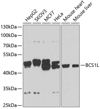 BCS1L Antibody