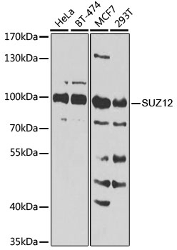 SUZ12 Antibody, KO Validated