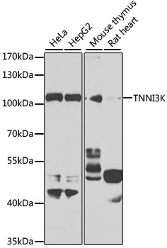 TNNI3K Antibody