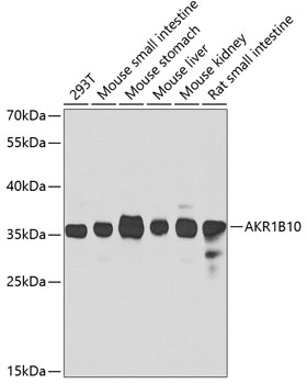 AKR1B10 Antibody
