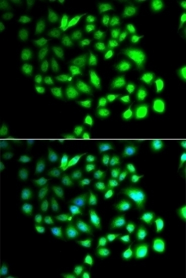 TCEAL8 Antibody
