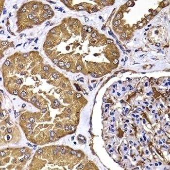 TGS1 Antibody
