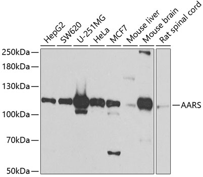 AARS Antibody