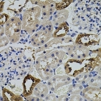 AURKC Antibody