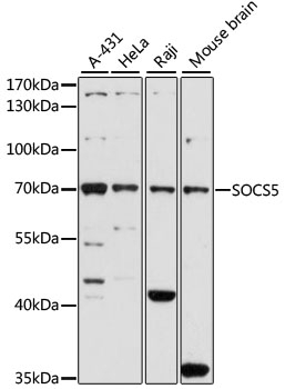 SOCS5 Antibody