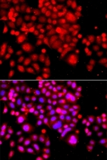 ASCC3 Antibody