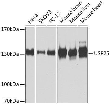 USP25 Antibody