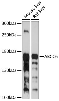ABCC6 Antibody
