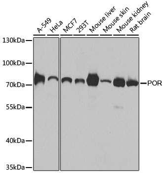 POR Antibody, KO Validated