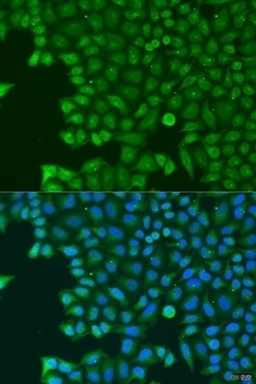 ABCE1 Antibody