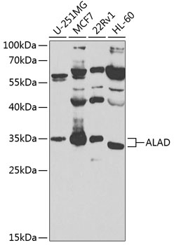 ALAD Antibody