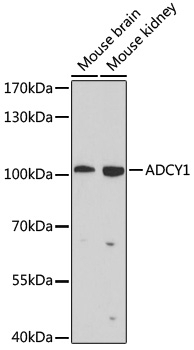 ADCY1 Antibody