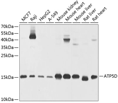 ATP5D Antibody