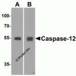 Western blot analysis of caspase-12 in mouse brain tissue lysate in the absence (A) or presence (B) of blocking peptide (2327P) with caspase-12 antibody (IN) at 1 μg/mL.