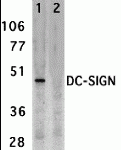 Western blot analysis of DC-SIGN expression in human placenta tissue lysate in the absence (lane 1) and presence (lane 2) of blocking peptide (2349P) with DC-SIGN antibody at 2 μg /ml.