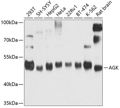 AGK Antibody
