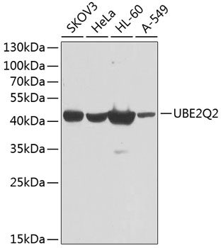 UBE2Q2 Antibody