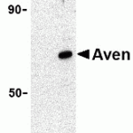 Western blot analysis of PID expression in HeLa whole cell lysates in the absence (A) or presence (B) of blocking peptide with PID antibody at 1 μg /ml (2443P).