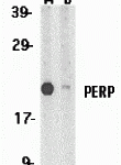 Western blot analysis of PERP expression in A431 whole cell lysates in the absence (A) and presence (B) of blocking peptide (2451P) with PERP antibody at 1 μg /ml.