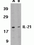 Western blot analysis of IL-21 expression in HL-60 cell lysate in the absence (lane A) or presence of blocking peptide (2465P) (lane B) with IL-21 antibody at 1 μg /ml.