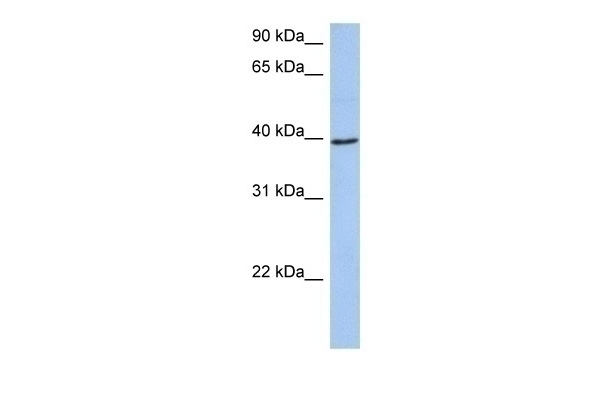ACADM Antibody