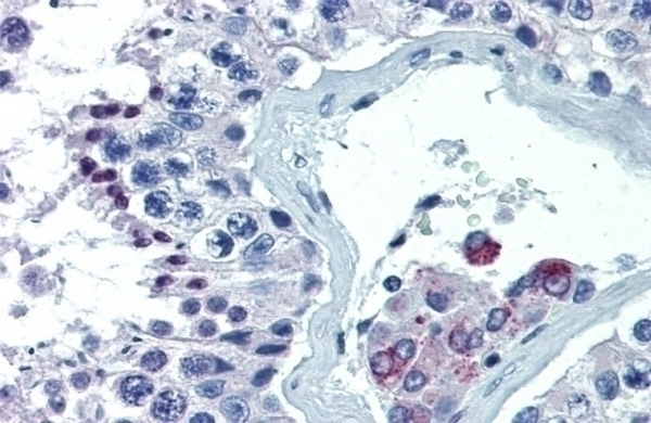 ASH2L Antibody