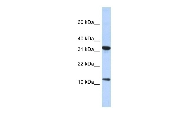 BTF3L1 Antibody