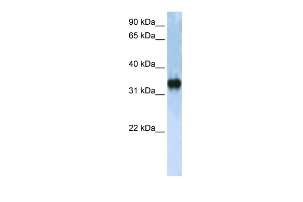 ZCCHC17 Antibody