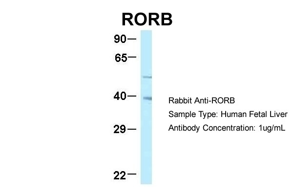 What Is A Rorb Model RORB Antibody - Cat. No. 25-456 | ProSci