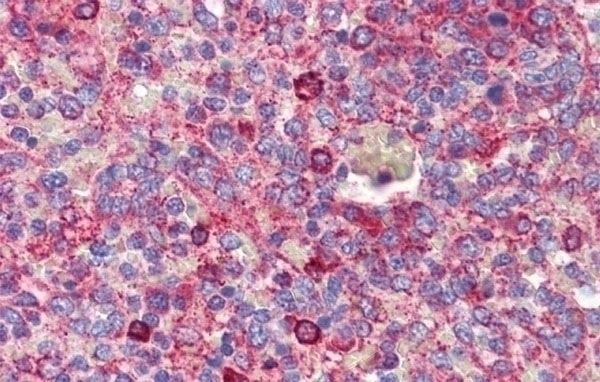 BCL11A Antibody