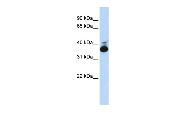 ALDOB Antibody