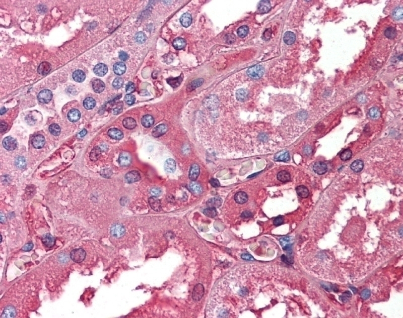 Albumin Antibody