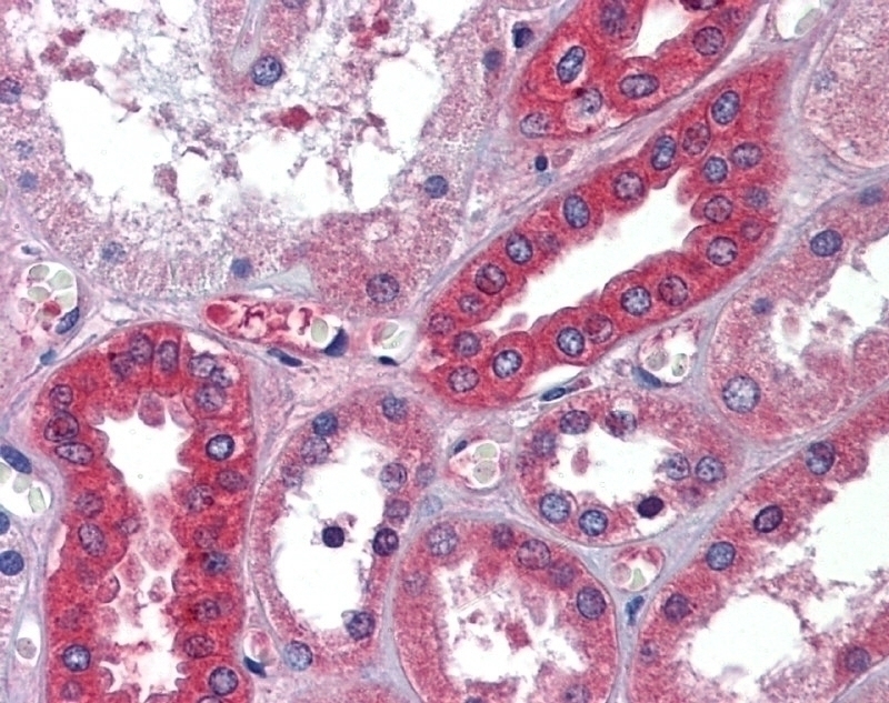 Albumin Antibody