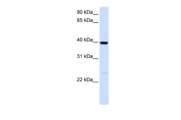 ADH1A Antibody