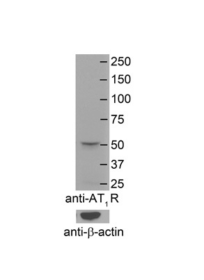 AGTR1 Antibody