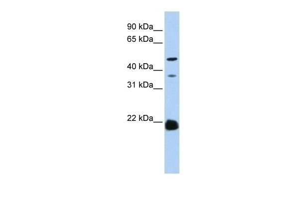 ZDHHC14 Antibody