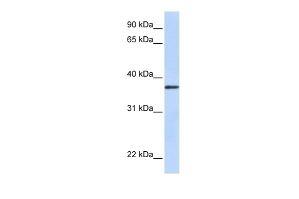 TTMB Antibody