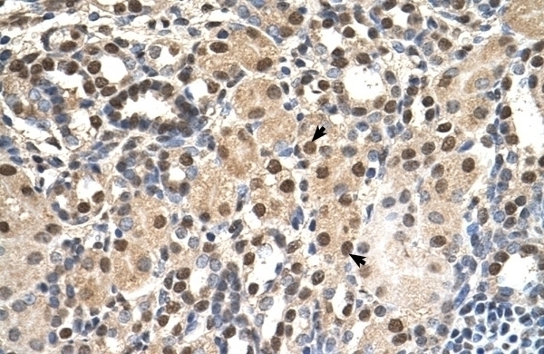 ANP32E Antibody